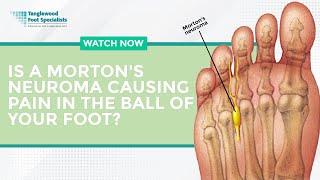 Is a Morton's Neuroma Causing Pain in the Ball of Your Foot?