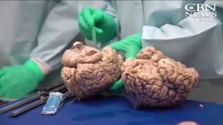 Football Players Suffer 'Shocking' Brain Damage: 'Enormous Public Health Concerns'
