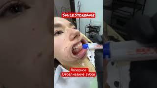 Самое современное Лазерное отбеливание зубов, безопасно для эмали! Башня Федерации, Москва