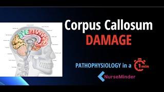 Pathophysiology for Nursing: Corpus Callosum and the Nervous System