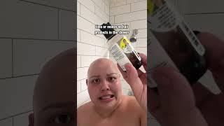 it’s a superpower tbh #shortsvideo #alopecia #youtubeshorts #alopeciaawareness #bald