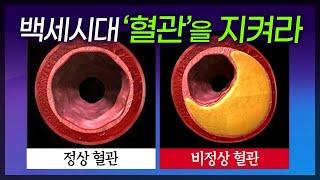 혈관의 5가지 적 / 심장혈관을 짓누르는 주범, 당뇨병 / 내 혈관이 깨끗한지 알아보는 방법/ / 부산mbc TV닥터인사이드 20161204