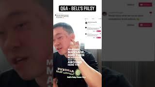 Q&A - Bell’s Palsy