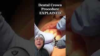 Dental Crown Procedure | In Office to Hands On Dental Training