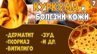 КУРКУМА (видео 7): болезни кожи. Псориаз. Дерматит. Витилиго.