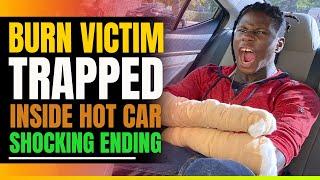 Foster Parent Leaves Black Burn Victim In Hot Car. Then This Happens