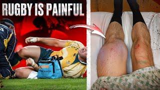 Don't Watch This BRUTAL Rugby Video