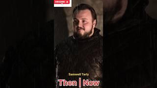 Game of trons THEN AND NOW  John Bradley/Samwell Tarly THEN AND NOW 