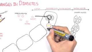 Diabetes Complication and Pathophysiology of the complication