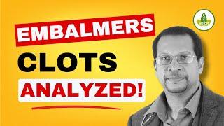 The Embalmer Analysis Results Will Blow Your Mind