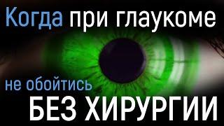 Когда при глаукоме не обойтись без хирургии