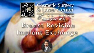 Breast Revision + Implant Exchange - Cosmetic Surgery and Laser Center of El Paso | Dr. Mark Jabor
