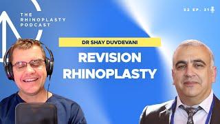 Revision Rhinoplasty with Dr. Shay Duvdevani