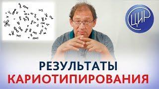 Анализ на КАРИОТИП (кариотипирование). КАК ИНТЕРПРЕТИРОВАТЬ анализ на кариотип? Гузов И.И.