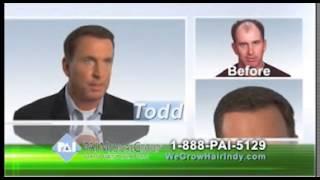 Hair Transplants: Multi-Unit Hair Grafting from PAI Medical Group of Indiana