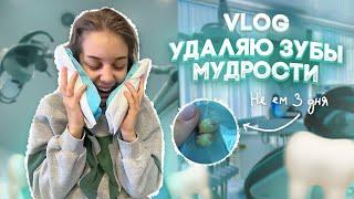 VLOG: МНЕ УДАЛИЛИ 2 ЗУБА ОДНОВРЕМЕННО | УМИРАЮ ОТ БОЛИ