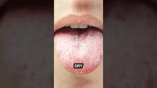 Ozone Water Flosser- Revolutionary Tool for Dry Mouth