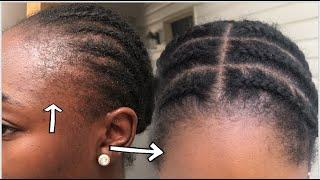 How I grow my damaged edges fast | 4 products I used + 4 things I stopped doing | Shocking Results