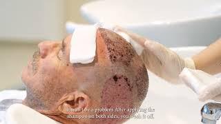 How To Do Special Washing After The Hair Transplant I Medart Hair Clinic