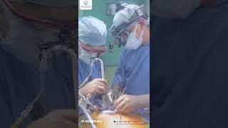 Minimally Invasive CABG Surgery | Dr. Kshitij Dubey Indore