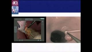 PG Course: Fundamentals of Endoscopic Surgery (FES) - Simulation and Skill Acquisition