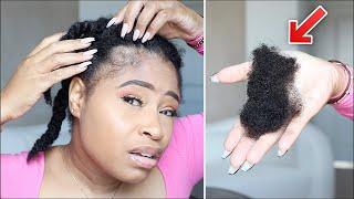 MY HAIR IS FALLING OUT IN CLUMPS! | How I Disguise It FAST