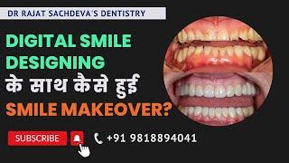 Smile Makeovers by Dr. Rajat Sachdeva |  Dentist In Delhi | Affordable Cosmetic Dentistry