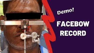 How to take a facebow record?