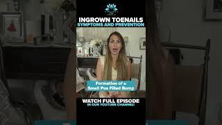 Ingrown Toenails | Symptoms and Prevention