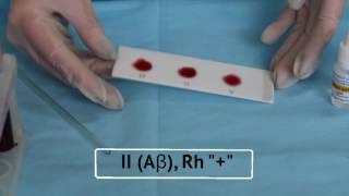 Blood typing technique