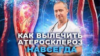 Как вылечить атеросклероз?