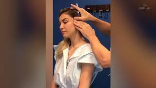 Ponytail Micro Lift Procedure by Dr. Miller