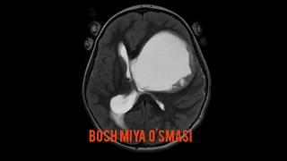 Bosh miya o'smasi diagnostikasi. #o'sma #MRI #МРТ #Braintumor #cancer #рак #анизокория #брадикардия