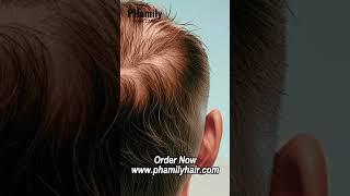 New Natural Hair Restoration for Bald Spots & Breakage | PHamily Hair Care