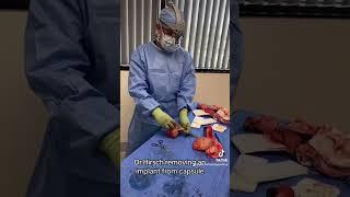 What does a textured breast implant look like? #health #medical #breastimplantillness #implant