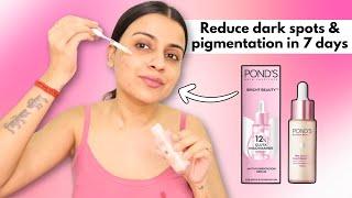 HOW TO REDUCE DARK SPOTS & PIGMENTATION | Spotless Clear Skin ft @PondsIndia  | Nidhi Chaudhary