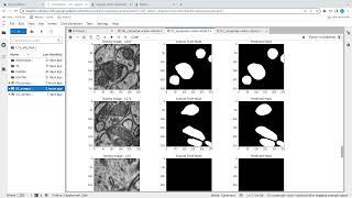 Computer Vision Models for Health Imaging Diagnostics Part 1