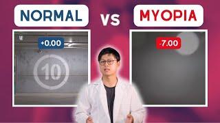 MYOPIA vs normal vision (POV)