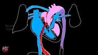 Fetal Circulation | Anatomy | Made easy | 3 minutes