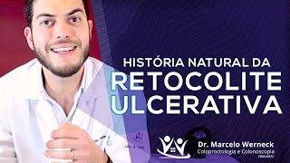 Como é a evolução da Retocolite Ulcerativa? | Dr. Marcelo Werneck