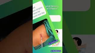Treatment options and screening for Pleural effusion #apollohospitals #vats #minimalinvasivesurgery