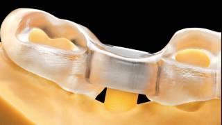 D II | 3D-Printers for Dental | Rapid Shape