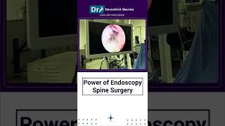 Power of Endoscopy Spine Surgery | Spine Surgery in Delhi-NCR & Agra | Dr Devashish Sharma