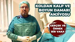 Koldan Kalp ve Boyun Damarı Anjiyosu (Gerçek Vaka)