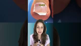 How to Treat Ingrown Nail | Nipun Kapur