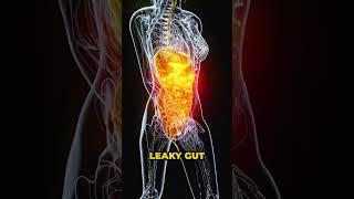 What is Causing Your Zinc Deficiency? #shorts #zinc #vitamin