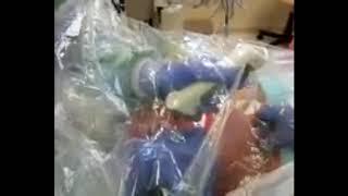 The Vie Scope® Used on a COVID-Positive Patient | 21 Sept 2020