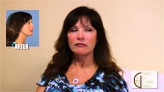 Lower Facelift, Neck Lift & Eyelid Lift | Newport Beach, California.