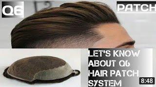 Cheapest hair solution in Mumbai @6000 call 9075156688 non surgical hair in Mumbai