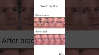Highly Relatable Memes #shorts